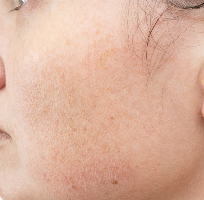 After — 8 weeks