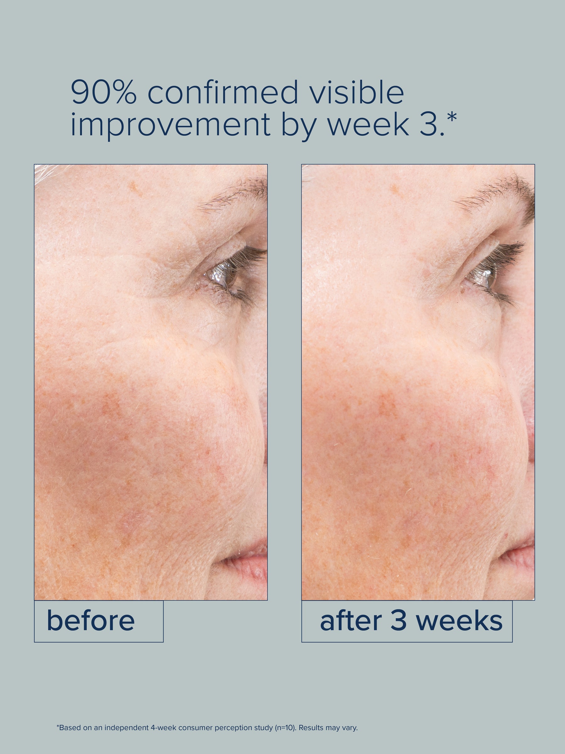 Rosé Regeneration Emulsion